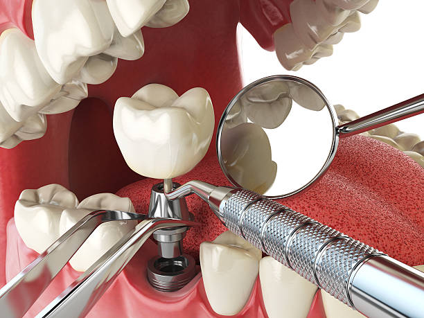 Best Emergency Treatment for Toothache in West Babylon, NY